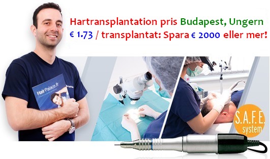Hårtransplantation pris i Budapest, Ungern